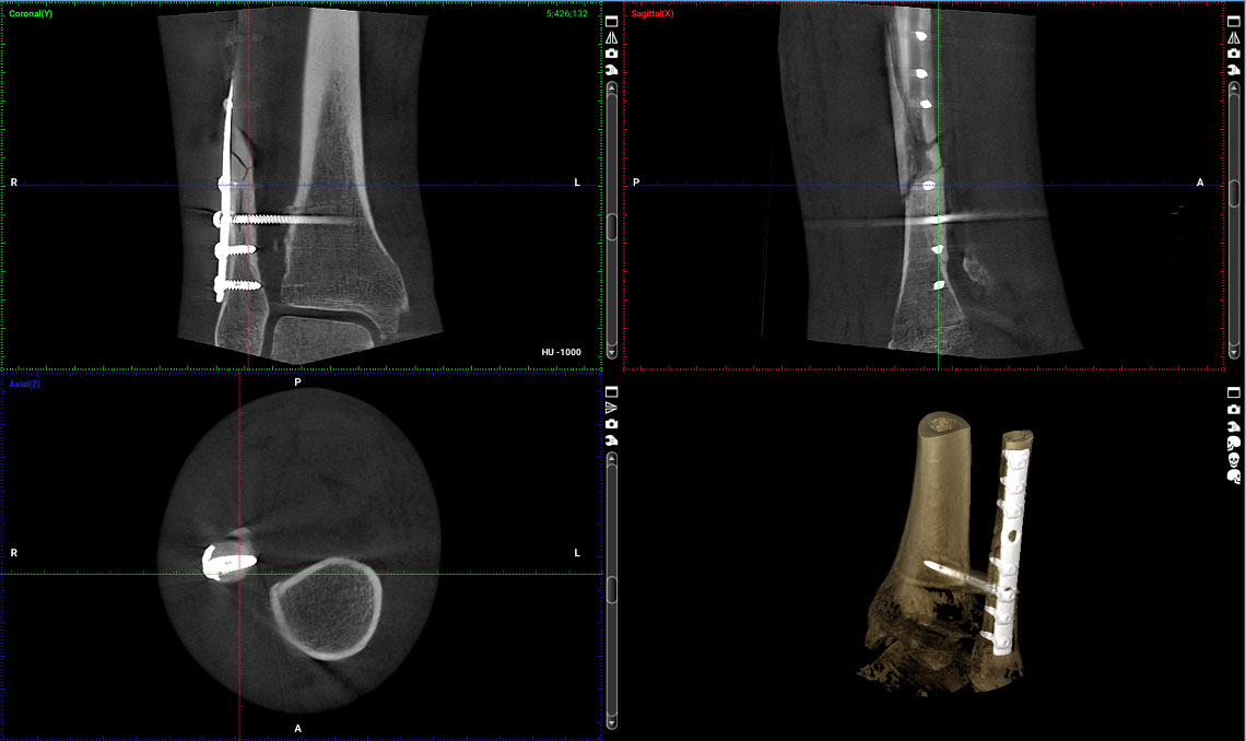 Products-Planmed-Verity-orthopedic-imaging-1a