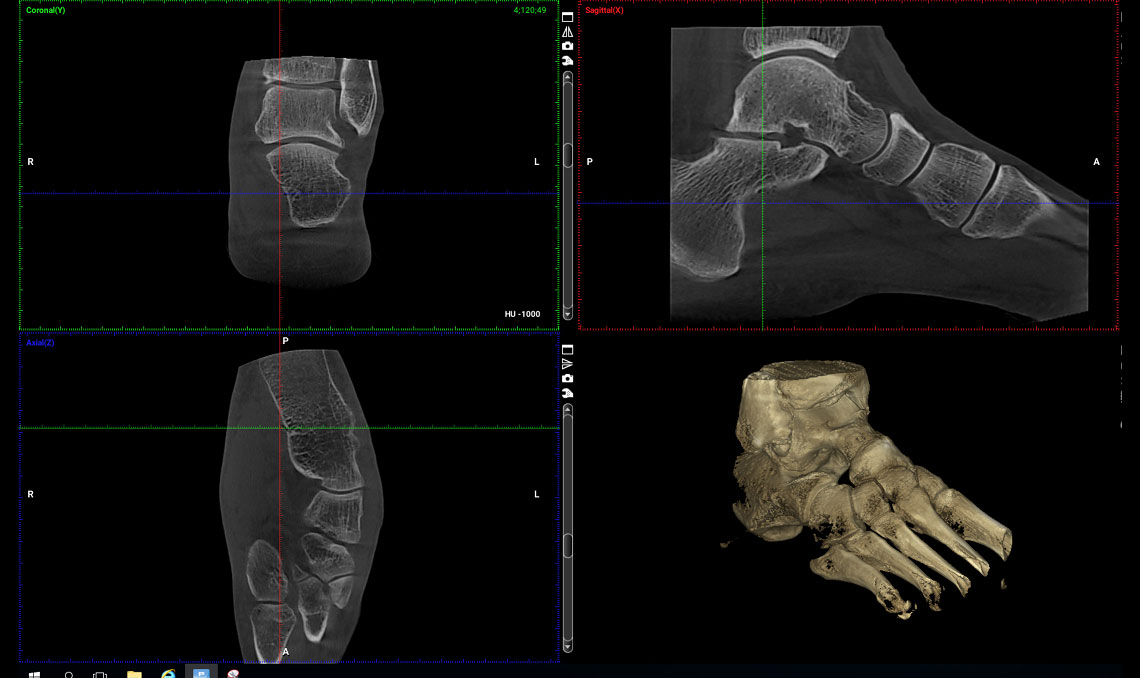 Products-Planmed-Verity-orthopedic-imaging-4a