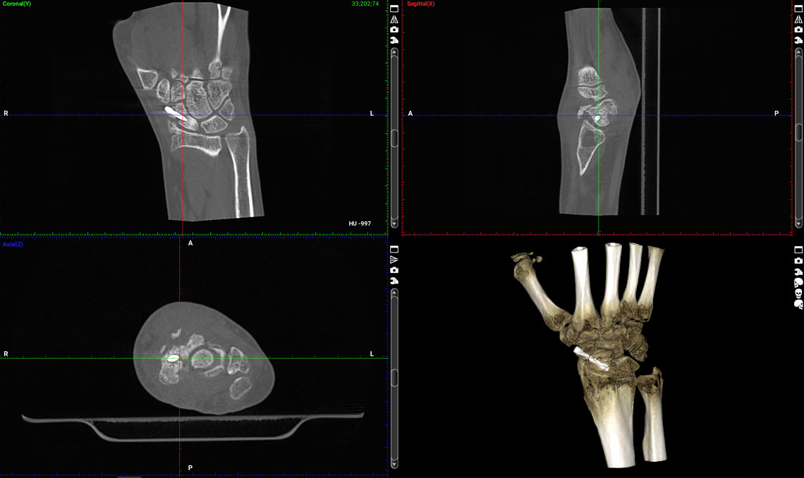 Products-Planmed-Verity-orthopedic-imaging-6a